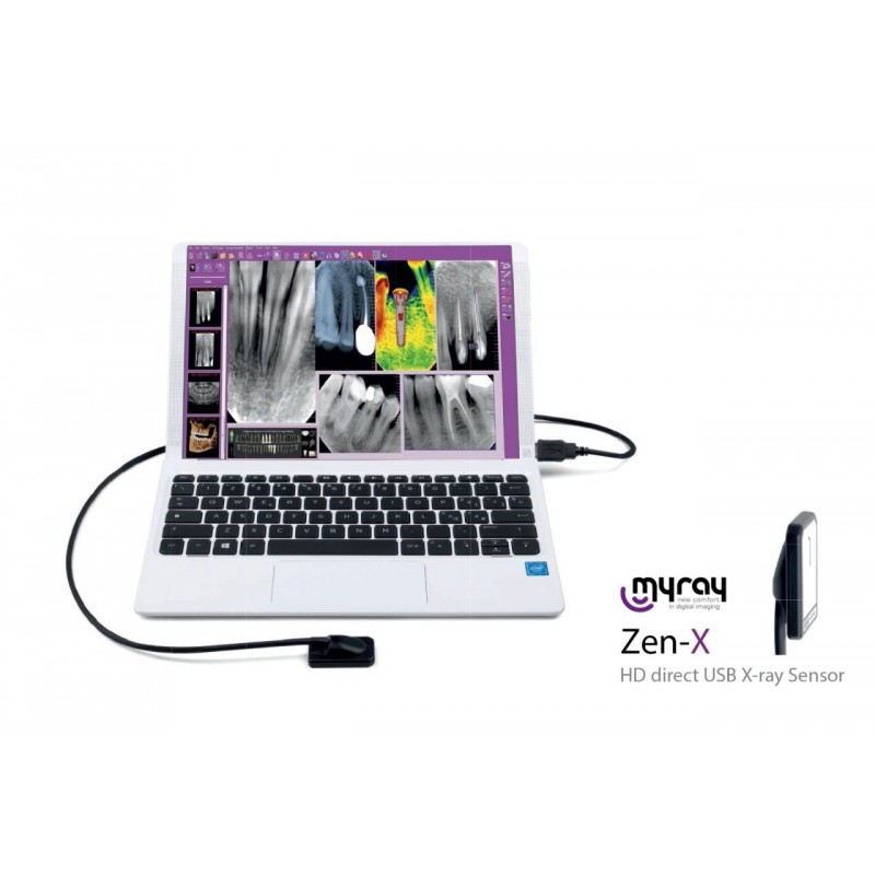 Myray Zen-x size 1 RVG